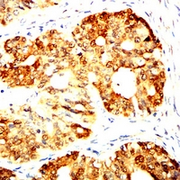 PGP9.5 Mouse Monoclonal Antibody