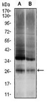 UBB Mouse Monoclonal Antibody