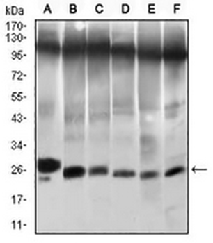 TWIST Mouse Monoclonal Antibody