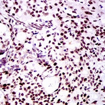 TWIST Mouse Monoclonal Antibody