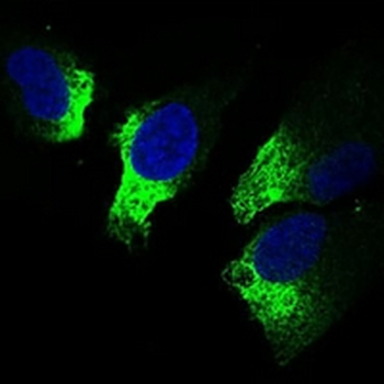 TWIST Mouse Monoclonal Antibody
