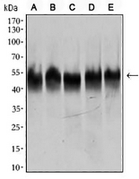 Beta2A-tubulin Mouse Monoclonal Antibody