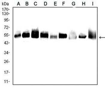 Alpha-tubulin 4a Mouse Monoclonal Antibody