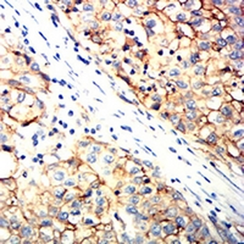 Tetraspanin 8 Mouse Monoclonal Antibody