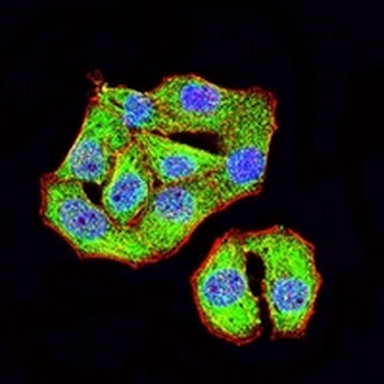 TRIM29 Mouse Monoclonal Antibody