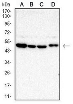 TRIB2 Mouse Monoclonal Antibody