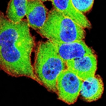 TRIB2 Mouse Monoclonal Antibody