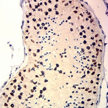 TRBC1 Mouse Monoclonal Antibody