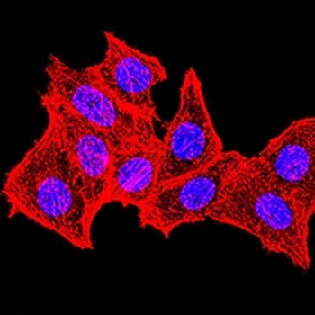 Topoisomerase 2 alpha Mouse Monoclonal Antibody