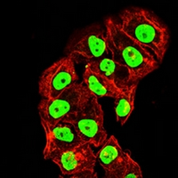 Topoisomerase 1 Mouse Monoclonal Antibody