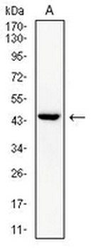 cTnT Mouse Monoclonal Antibody