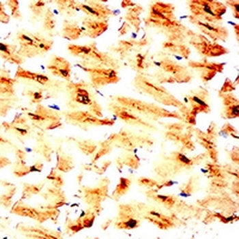 cTnT Mouse Monoclonal Antibody