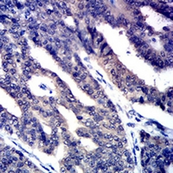CD258 Mouse Monoclonal Antibody