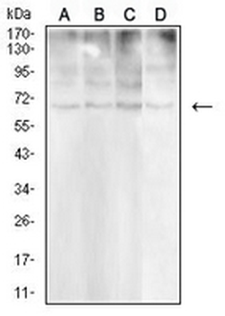 CD30 Mouse Monoclonal Antibody