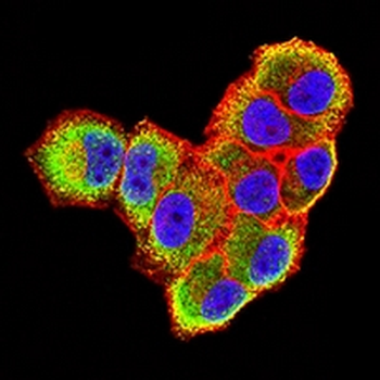 CD30 Mouse Monoclonal Antibody