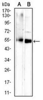 CD265 Mouse Monoclonal Antibody