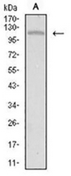 TIE1 Mouse Monoclonal Antibody