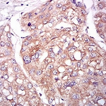 TIE1 Mouse Monoclonal Antibody