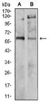 Tyrosine Hydroxylase Mouse Monoclonal Antibody