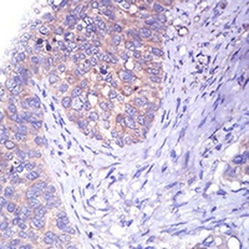 Tyrosine Hydroxylase Mouse Monoclonal Antibody