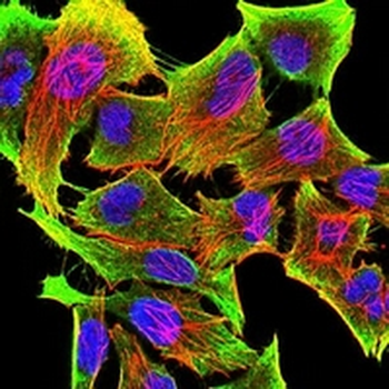 Tyrosine Hydroxylase Mouse Monoclonal Antibody