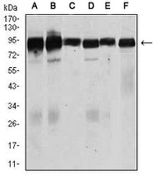 TGFBR3 Mouse Monoclonal Antibody