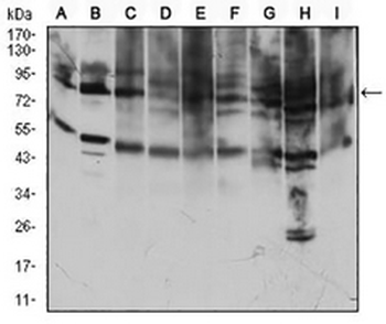 CD71 Mouse Monoclonal Antibody