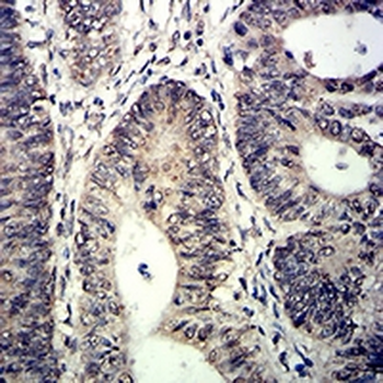 TET2 Mouse Monoclonal Antibody