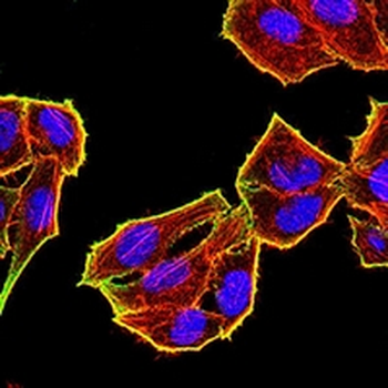 TET2 Mouse Monoclonal Antibody