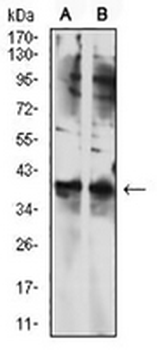 TBP Mouse Monoclonal Antibody