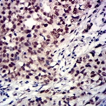 TBP Mouse Monoclonal Antibody