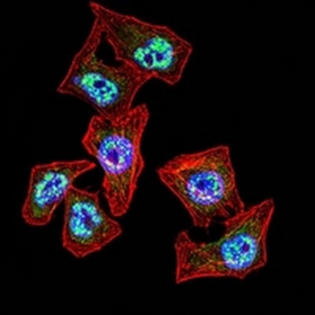 TBP Mouse Monoclonal Antibody