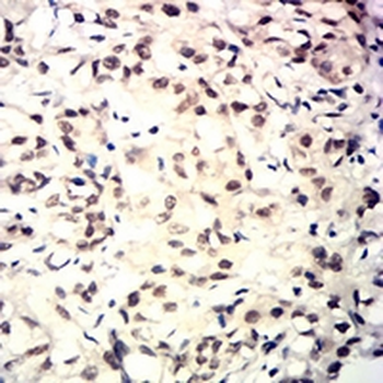 TARDBP Mouse Monoclonal Antibody