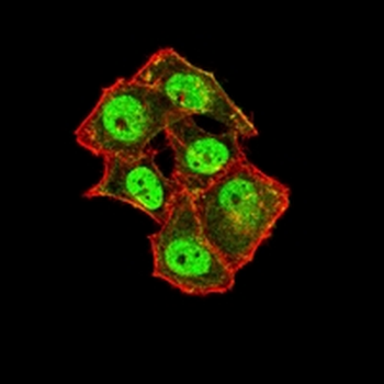 TARDBP Mouse Monoclonal Antibody