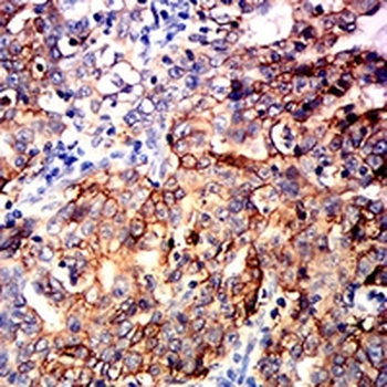 TACSTD2 Mouse Monoclonal Antibody
