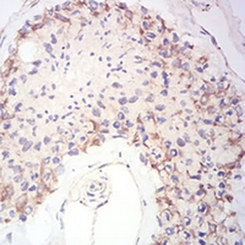 Synapsin 1 Mouse Monoclonal Antibody