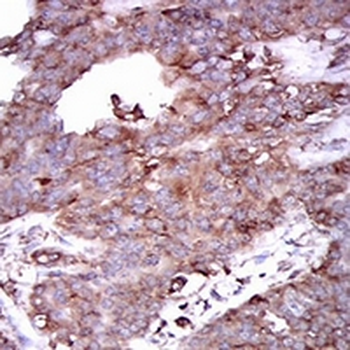 STAT5A Mouse Monoclonal Antibody