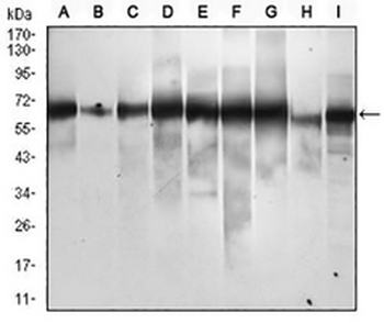 p62 Mouse Monoclonal Antibody