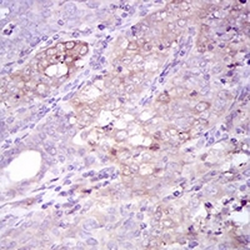 p62 Mouse Monoclonal Antibody