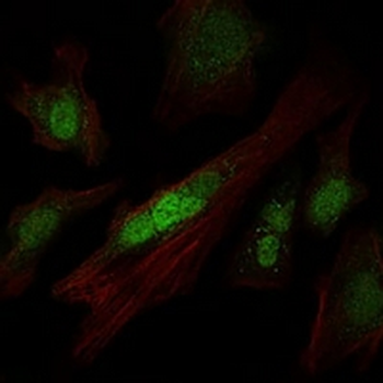 SOX9 Mouse Monoclonal Antibody
