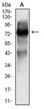 SOX11 Mouse Monoclonal Antibody