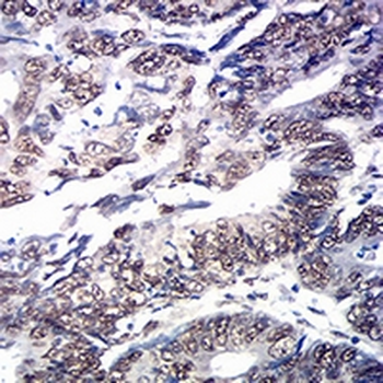 SOX11 Mouse Monoclonal Antibody
