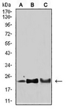 SOD2 Mouse Monoclonal Antibody