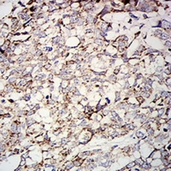 SOD2 Mouse Monoclonal Antibody