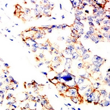 SOCS3 Mouse Monoclonal Antibody