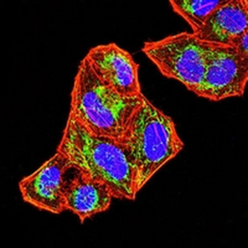 SOCS3 Mouse Monoclonal Antibody