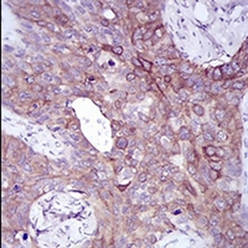 SLUG Mouse Monoclonal Antibody