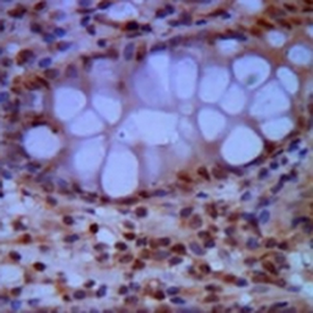 SMC1A Mouse Monoclonal Antibody