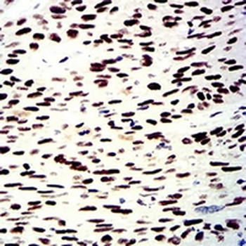 SNF2L Mouse Monoclonal Antibody