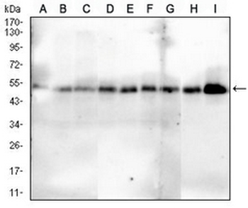 SMAD1 Mouse Monoclonal Antibody